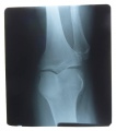 obrazek do "X-ray" po polsku